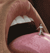 Emi